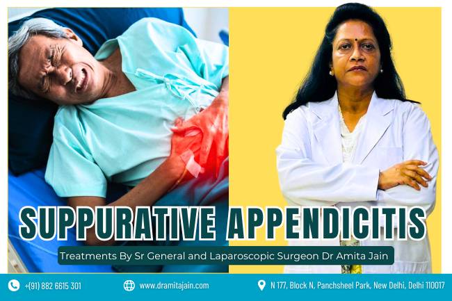 Dr Amita Jain best surgeon for Suppurative Appendicitis